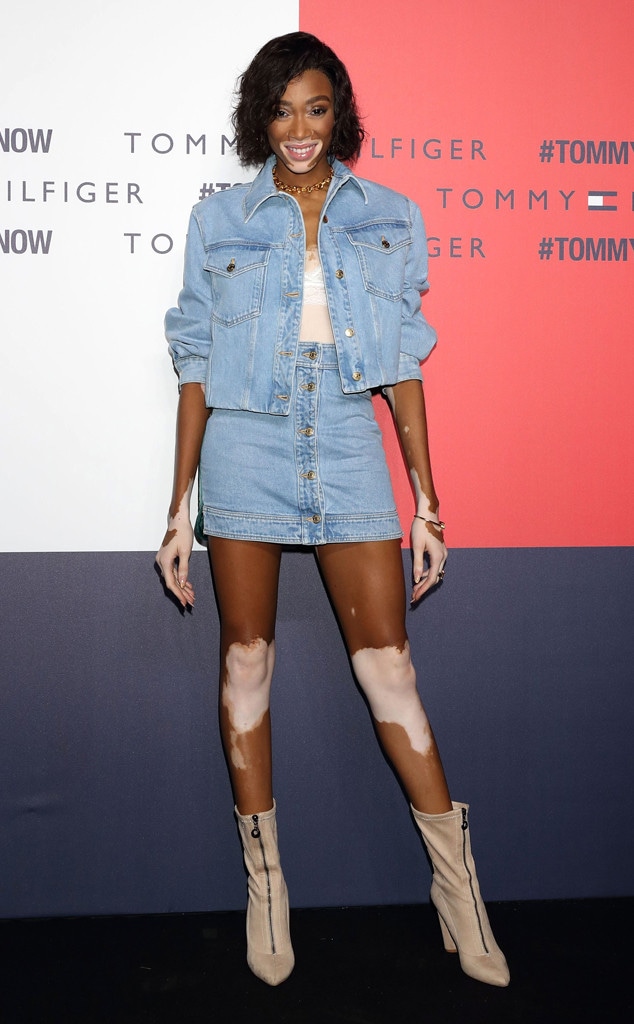 Winnie Harlow Shares Her ''Truth'' Amid ANTM Controversy - E! Online - CA